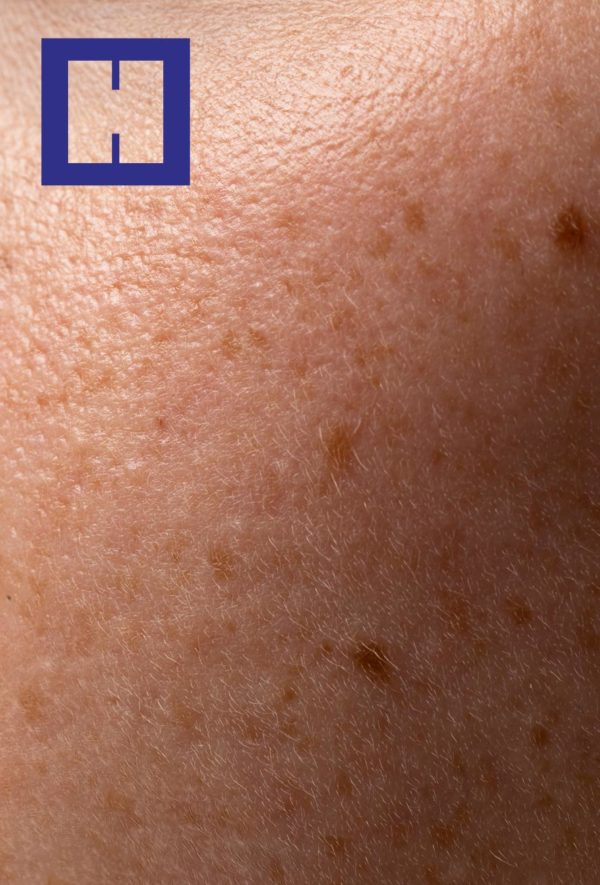 ITS y otras enfermedades infecciosas